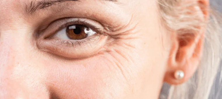 Tudo sobre toxina botulínica